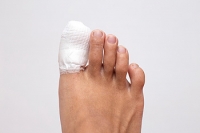 Is My Toe Mildly or Severely Fractured?