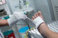 Diabetic Foot Ulcers and Wounds