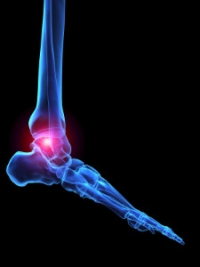 Can My Ankle Pain Be Caused by Arthritis? 